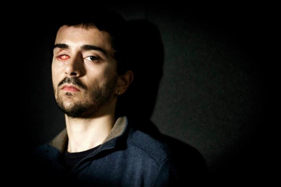 Colpito da un proiettile perse un occhio, indagati due poliziotti