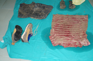 Cadavere sulla spiaggia di Campomarino, s’indaga per omicidio