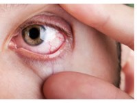 Disturbi della vista e diabete, incontro a Isernia sulla prevenzione