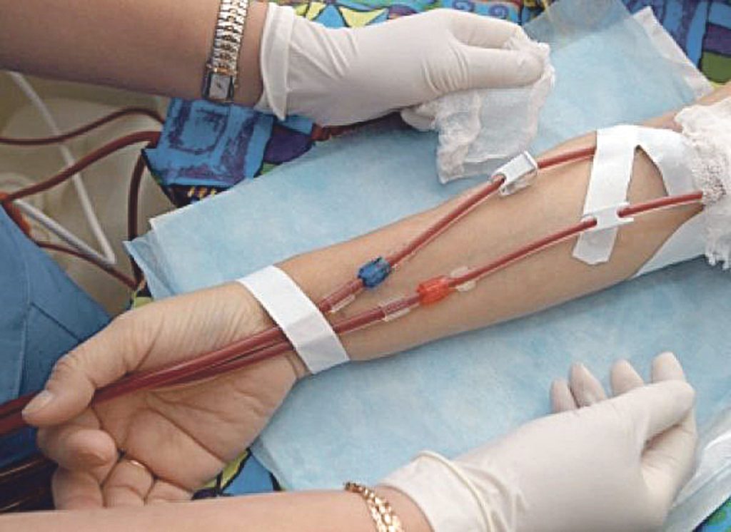 Vinchiaturo, la lettera di Katia ai medici del Cardarelli: «Grazie per avermi salvato la vita»