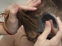 Altro che Coronavirus, alla scuola di Infanzia di Venafro ci sono i pidocchi: il preside allerta i genitori