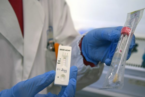 Kit rapidi per scovare gli asintomatici: migliaia in altre Regioni, in Molise no