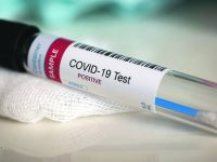 Caso positivo a Roccavivara, «difetto di comunicazione»: Gravina scagiona Antenucci e Asrem