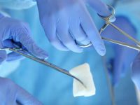 Truffano il Sistema sanitario operando finti tumori, ma è chirurgia plastica