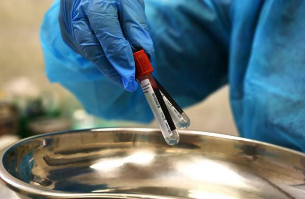 Il 13 porta bene, un altro giorno senza nuovi contagi e il numero dei guariti sale