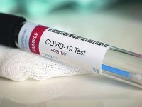 In Molise torna la paura, cluster migranti a Isernia e Campomarino: sei casi