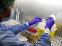 Nuovo record di contagi, 65 in un solo giorno: sale il conto dei ricoveri