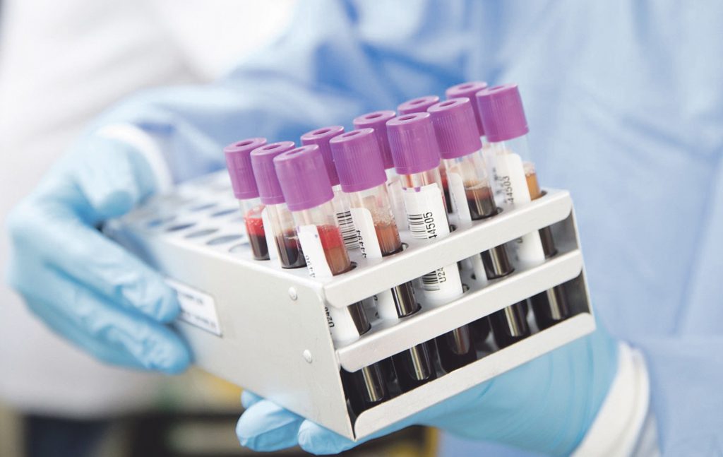 Il coronavirus colpisce altre 86 persone