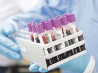 Il coronavirus colpisce altre 86 persone