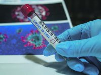 Due decessi e 88 nuovi positivi, sale la pressione sulla terapia intensiva