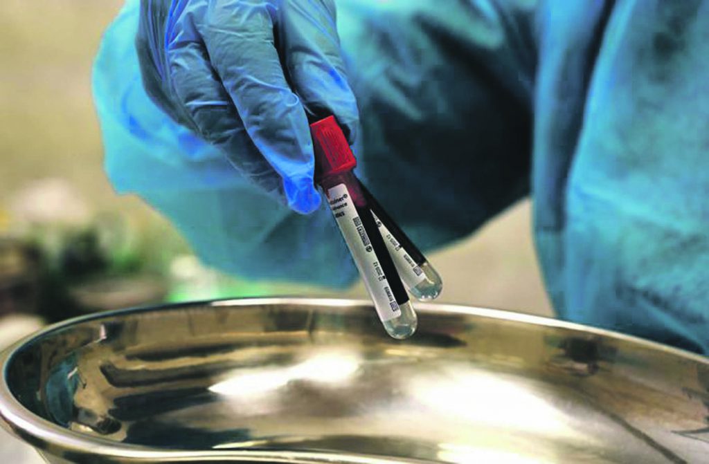 A nurse holds screw cap tubes after performing blood samples on an urban policeman, as part of a serological test for COVID-19 on May 6, 2020 at the Capitoline Hill (Campidoglio) municipal building in Rome, during the country's lockdown aimed at curbing the spread of the COVID-19 infection, caused by the novel coronavirus. (Photo by Vincenzo PINTO / AFP)