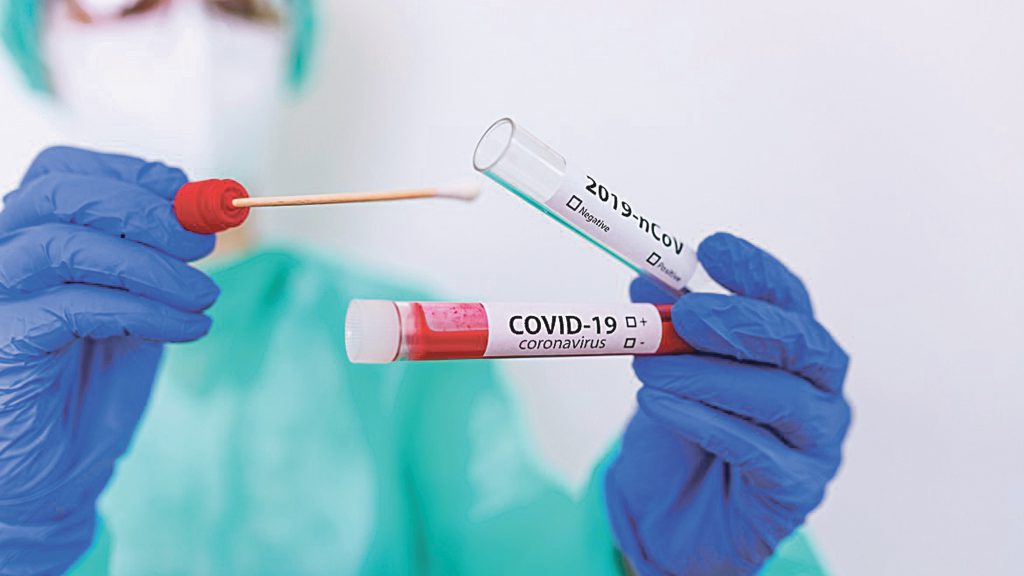 Casi di nuovo su: altri 77 contagi e non si ferma la conta dei morti