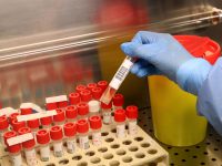 Medical biologists and laboratory technicians wearing protective gear working with swabs samples in a laboratory of Microbiology and Virology, where tests for SARS-CoV-2 which causes the COVID-19 disease are conducted for suspected cases.. on April 28, 2020 in Milan, Italy. Photo by Clemente Marmorino/Eyepix/ABACAPRESS.COM (Marmorino Clemente/Eyepix/ABACA / IPA/Fotogramma, Milan - 2020-04-28) p.s. la foto e' utilizzabile nel rispetto del contesto in cui e' stata scattata, e senza intento diffamatorio del decoro delle persone rappresentate