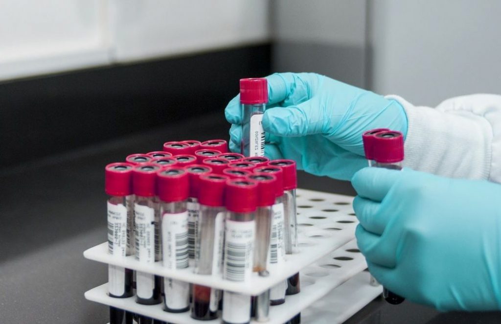 Covid a Bojano, dolore infinito: quarta vittima in 7 giorni