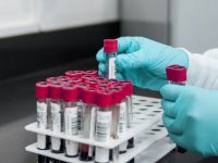 Covid a Bojano, dolore infinito: quarta vittima in 7 giorni