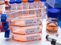 Un ricovero e sette guariti, variante Delta nel mirino del laboratorio molecolare