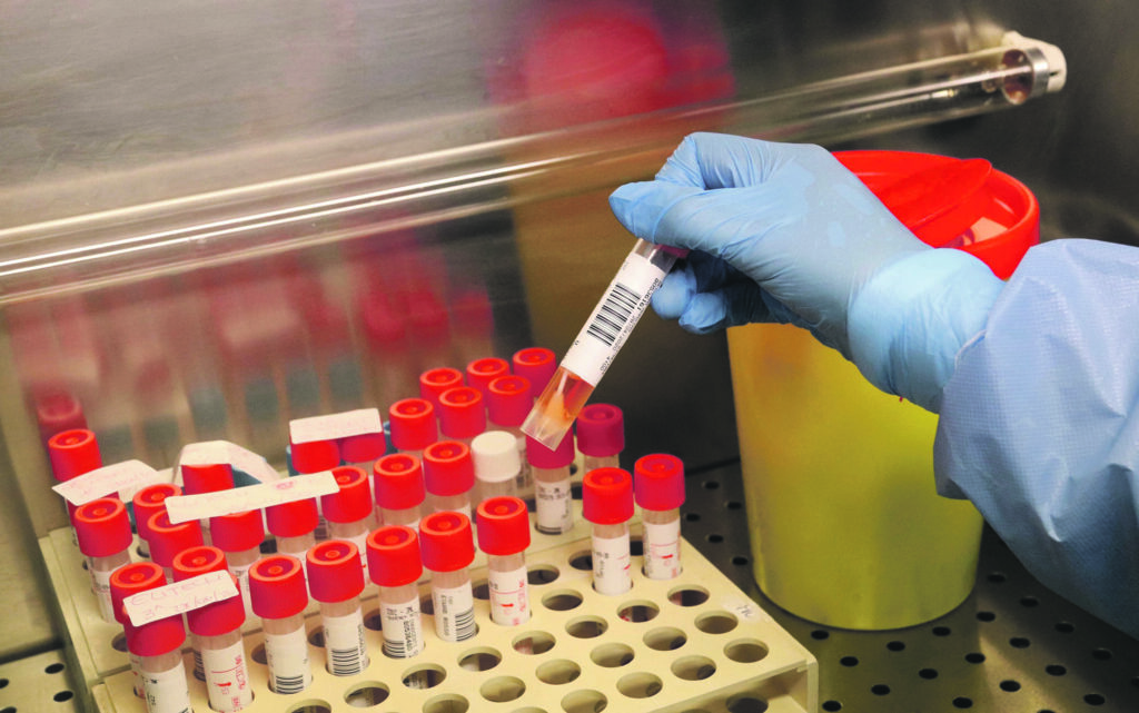 Medical biologists and laboratory technicians wearing protective gear working with swabs samples in a laboratory of Microbiology and Virology, where tests for SARS-CoV-2 which causes the COVID-19 disease are conducted for suspected cases.. on April 28, 2020 in Milan, Italy. Photo by Clemente Marmorino/Eyepix/ABACAPRESS.COM (Marmorino Clemente/Eyepix/ABACA / IPA/Fotogramma, Milan - 2020-04-28) p.s. la foto e' utilizzabile nel rispetto del contesto in cui e' stata scattata, e senza intento diffamatorio del decoro delle persone rappresentate