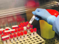 Medical biologists and laboratory technicians wearing protective gear working with swabs samples in a laboratory of Microbiology and Virology, where tests for SARS-CoV-2 which causes the COVID-19 disease are conducted for suspected cases.. on April 28, 2020 in Milan, Italy. Photo by Clemente Marmorino/Eyepix/ABACAPRESS.COM (Marmorino Clemente/Eyepix/ABACA / IPA/Fotogramma, Milan - 2020-04-28) p.s. la foto e' utilizzabile nel rispetto del contesto in cui e' stata scattata, e senza intento diffamatorio del decoro delle persone rappresentate