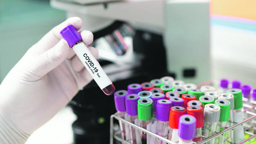 Il virus accelera, 20 casi ma nessun ricovero