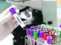 Il virus accelera, 20 casi ma nessun ricovero