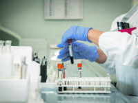 Ventotto casi su 462 tamponi e il tasso di positività va al 6%