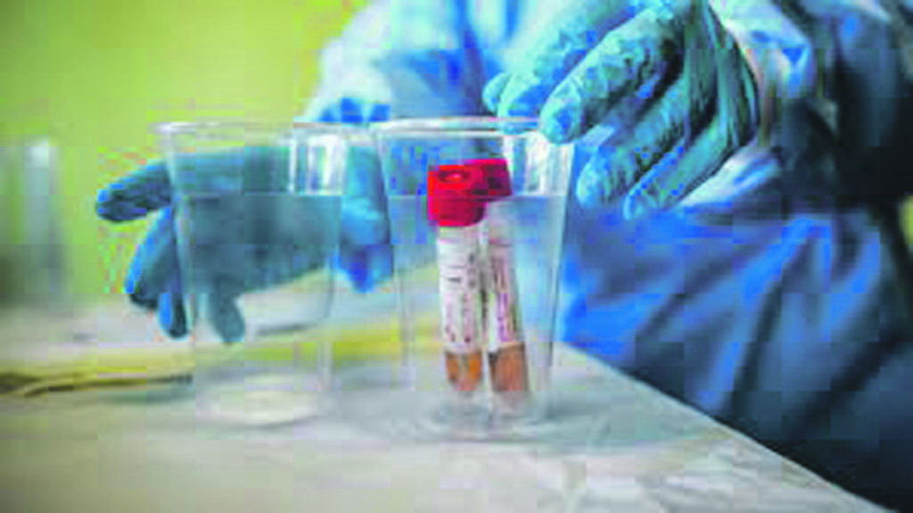 Altri 15 casi su 367 test, il tasso risale al 4%