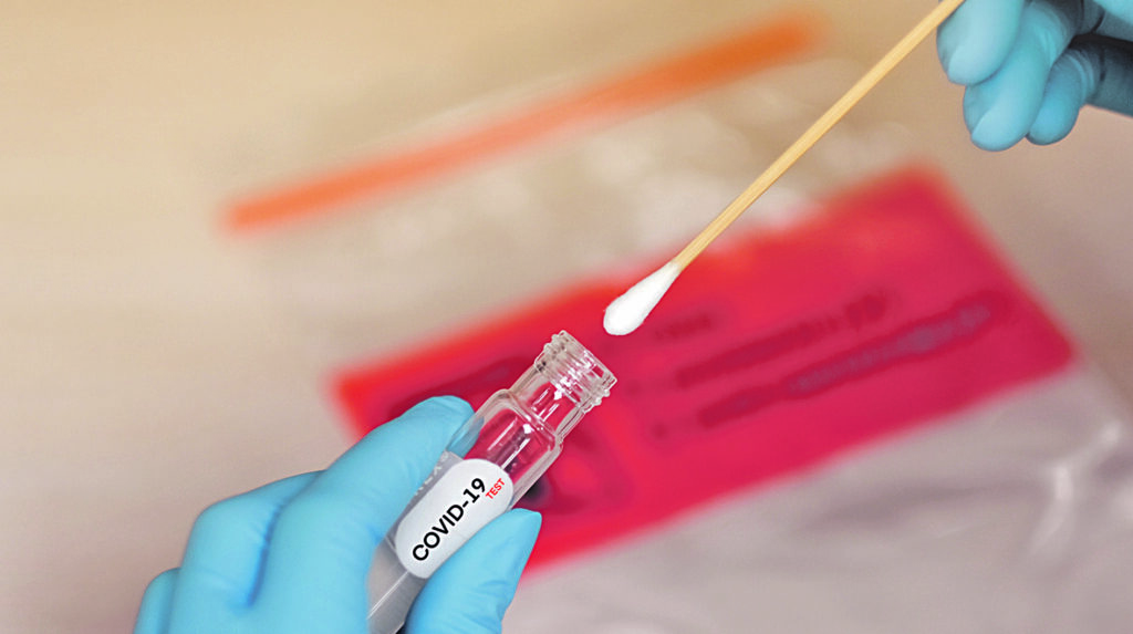 Covid, altri 9 contagi e nessun guarito