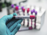 Blood test samples for presence of coronavirus (COVID-19) tube containing a blood sample that has tested positive for coronavirus.
