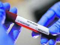 Tregua Covid: un solo positivo, tasso azzerato e altri 12 guariti