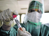 Quattro positivi e un ricovero, aumentano i guariti: ieri 15