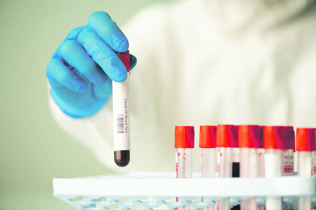 Dieci positivi, tasso sopra il 2%: ma in 5 hanno superato il virus