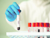 Dieci positivi, tasso sopra il 2%: ma in 5 hanno superato il virus