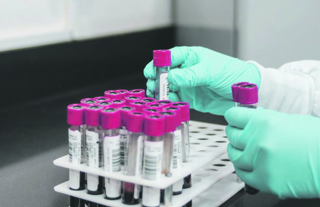 Lo spettro della quarta ondata: 36 casi in 24 ore