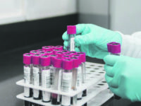 Lo spettro della quarta ondata: 36 casi in 24 ore