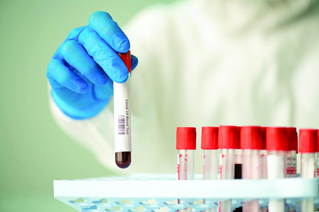 Ancora un boom di casi, i contagi attivi salgono a 359