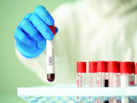 Ancora un boom di casi, i contagi attivi salgono a 359