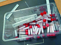 Termoli, screening per gli studenti dopo i contagi in classe