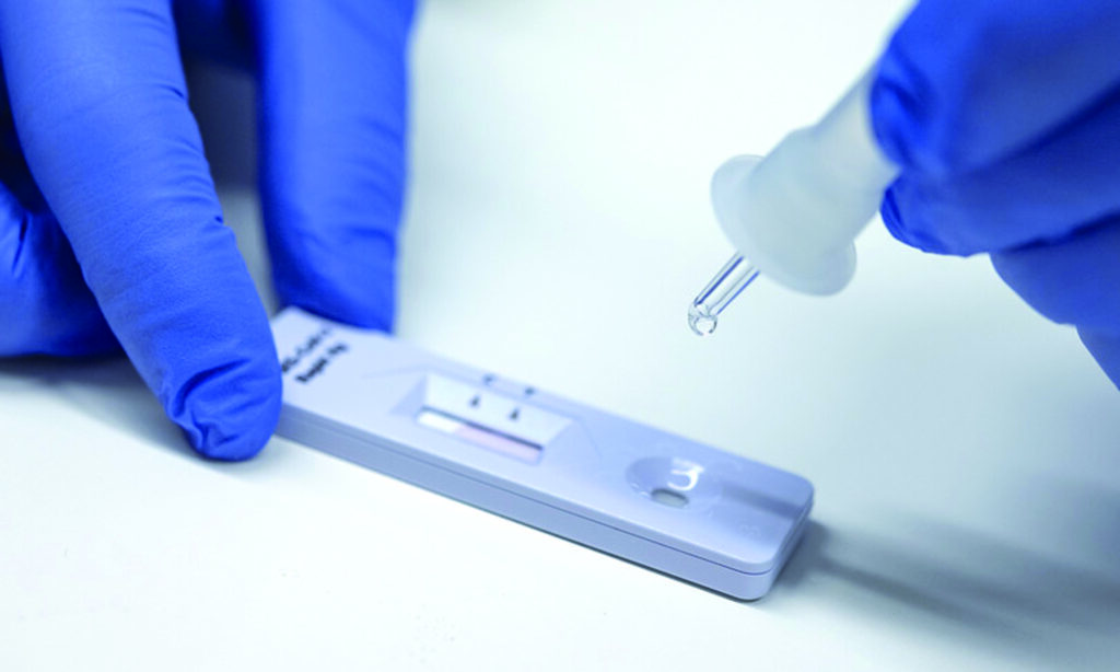 Test Covid-19, cinque rossoblù positivi: nuovo giro di tamponi previsto lunedì