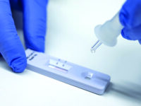 Test Covid-19, cinque rossoblù positivi: nuovo giro di tamponi previsto lunedì