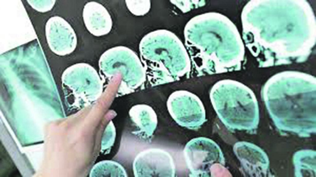 Piano 19-21 bocciato: manca la definizione della rete ictus