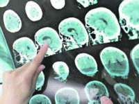 Piano 19-21 bocciato: manca la definizione della rete ictus