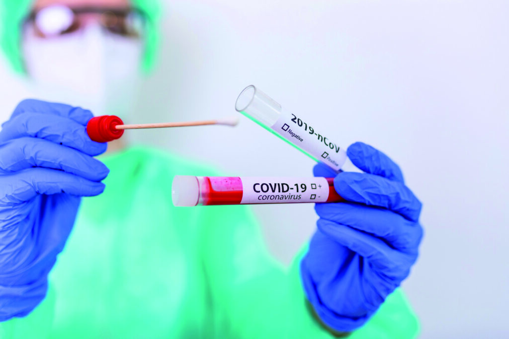 Altri 155 contagi, un decesso e un ricovero