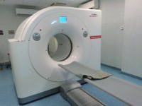 Meno radiazioni e performance migliori: con la Pet del Cardarelli terapie oncologiche più efficaci