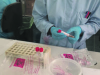 Tasso al 25,4%: i casi attivi salgono a 1.795