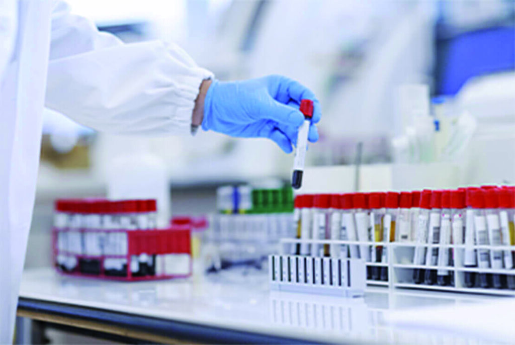 104 casi e 550 guariti, i contagi attivi scendono sotto 3mila