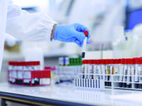 104 casi e 550 guariti, i contagi attivi scendono sotto 3mila