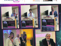 Riserva cognitiva, il tesoretto del cervello che permette di resistere agli effetti del tempo