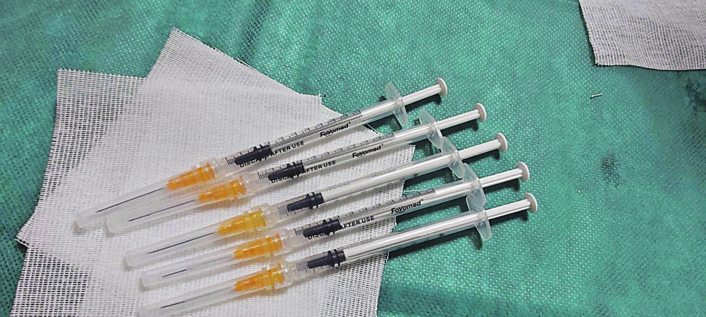 Sette dimessi, cala la pressione sul Cardarelli. Altri 169 positivi: casi attivi oltre 6.100