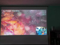 Al San Timoteo due interventi mini invasivi e innovativi 3D